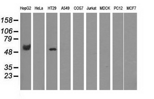 Western blot analysis of extracts (35ug) from 9 different cell lines by using anti-CORO1B monoclonal antibody