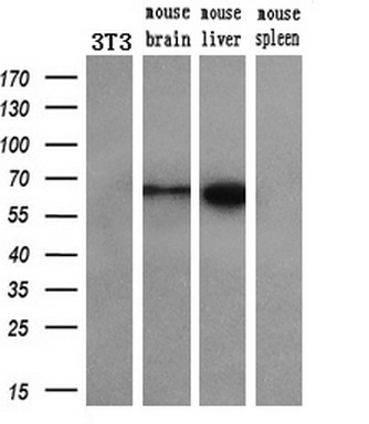 Western blot analysis of extracts (10ug) from a mouse cell line and 3 different mouse tissues by using anti-CORO1B monoclonal antibody (1:200)