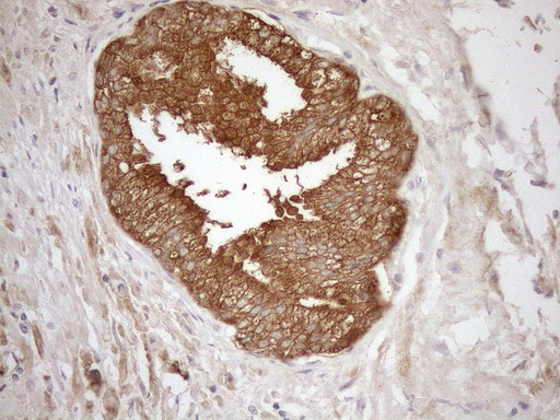 m10259 anti ngdn mouse monoclonal antibody clone id oti1h4 ihc testing 2