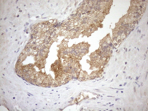 m10259 anti ngdn mouse monoclonal antibody clone id oti1h4 ihc testing 3
