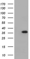 HEK293T cells were transfected with the pCMV6-ENTRY control (Left lane) or pCMV6-ENTRY DPPA4 (Right lane) cDNA for 48 hrs and lysed