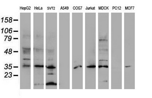 Western blot analysis of extracts (35ug) from 9 different cell lines by using anti-DPPA4 monoclonal antibody (HepG2: human; HeLa: human; SVT2: mouse; A549: human; COS7: monkey; Jurkat: human; MDCK: canine; PC12: rat; MCF7: human)