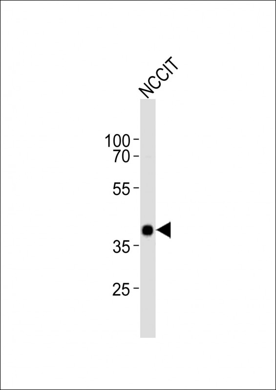 Anti-DPPA4 Antibody (Center) at 1:1000 dilution + NCCIT whole cell lysatesLysates/proteins at 20 µg per lane