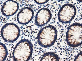 Immunohistochemical staining of paraffin-embedded Human colon tissue within the normal limits using anti-PYCR2 mouse monoclonal antibody