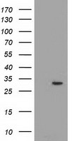 HEK293T cells were transfected with the pCMV6-ENTRY control (Left lane) or pCMV6-ENTRY PYCR2 (Right lane) cDNA for 48 hrs and lysed