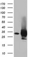 HEK293T cells were transfected with the pCMV6-ENTRY control (Left lane) or pCMV6-ENTRY PYCR2 (Right lane) cDNA for 48 hrs and lysed
