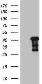 HEK293T cells were transfected with the pCMV6-ENTRY control (Left lane) or pCMV6-ENTRY MYOZ1 (Right lane) cDNA for 48 hrs and lysed
