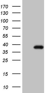 m10355 anti ctdsp2 mouse monoclonal antibody clone id oti7f5 wb testing 1