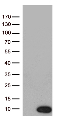 HEK293T cells were transfected with the pCMV6-ENTRY control (Left lane) or pCMV6-ENTRY NDUFA2 (Right lane) cDNA for 48 hrs and lysed