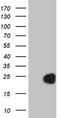 HEK293T cells were transfected with the pCMV6-ENTRY control (Left lane) or pCMV6-ENTRY CETN3 (Right lane) cDNA for 48 hrs and lysed
