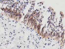 m10430 anti pecr mouse monoclonal antibody clone id oti2b2 ihc testing 4