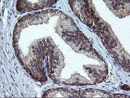 m10452 anti rab37 mouse monoclonal antibody clone id oti2f1 ihc testing 5