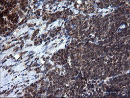 m10452 anti rab37 mouse monoclonal antibody clone id oti2f1 ihc testing 7
