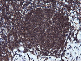 m10452 anti rab37 mouse monoclonal antibody clone id oti2f1 ihc testing 8