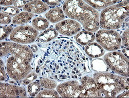 m10452 anti rab37 mouse monoclonal antibody clone id oti2f1 ihc testing 9