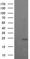 HEK293T cells were transfected with the pCMV6-ENTRY control (Left lane) or pCMV6-ENTRY RAB37 (Right lane) cDNA for 48 hrs and lysed