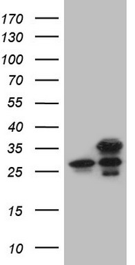 HEK293T cells were transfected with the pCMV6-ENTRY control (Left lane) or pCMV6-ENTRY GINS3 (Right lane) cDNA for 48 hrs and lysed