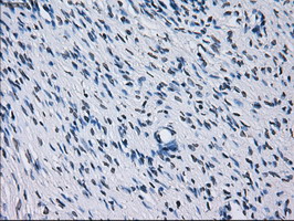 Immunohistochemical staining of paraffin-embedded Human Ovary tissue within the normal limits using anti-RNF144B mouse monoclonal antibody