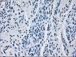 Immunohistochemical staining of paraffin-embedded Human endometrium tissue within the normal limits using anti-RNF144B mouse monoclonal antibody