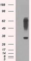 HEK293T cells were transfected with the pCMV6-ENTRY control (Left lane) or pCMV6-ENTRY RNF144B (Right lane) cDNA for 48 hrs and lysed
