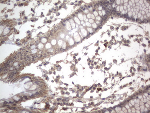 m10511 anti ddost mouse monoclonal antibody clone id oti2b4 ihc testing 10