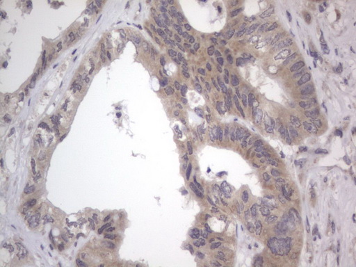 m10511 anti ddost mouse monoclonal antibody clone id oti2b4 ihc testing 11