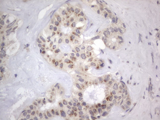 m10511 anti ddost mouse monoclonal antibody clone id oti2b4 ihc testing 14