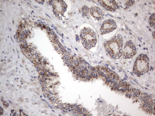 Immunohistochemical staining of paraffin-embedded Human prostate tissue within the normal limits using anti-DDOST mouse monoclonal antibody