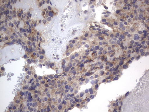 m10511 anti ddost mouse monoclonal antibody clone id oti2b4 ihc testing 9