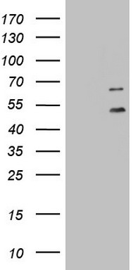 HEK293T cells were transfected with the pCMV6-ENTRY control (Left lane) or pCMV6-ENTRY DDOST (Right lane) cDNA for 48 hrs and lysed