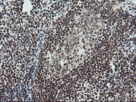 m10528 anti tprkb mouse monoclonal antibody clone id oti3h3 ihc testing 11
