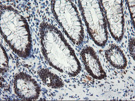 m10528 anti tprkb mouse monoclonal antibody clone id oti3h3 ihc testing 12