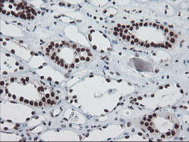 m10528 anti tprkb mouse monoclonal antibody clone id oti3h3 ihc testing 13