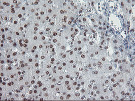 m10528 anti tprkb mouse monoclonal antibody clone id oti3h3 ihc testing 14
