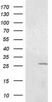 HEK293T cells were transfected with the pCMV6-ENTRY control (Left lane) or pCMV6-ENTRY OTUB2 (Right lane) cDNA for 48 hrs and lysed