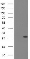 HEK293T cells were transfected with the pCMV6-ENTRY control (Left lane) or pCMV6-ENTRY OTUB2 (Right lane) cDNA for 48 hrs and lysed