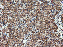 m10582 anti tle2 mouse monoclonal antibody clone id oti5a6 ihc testing 2