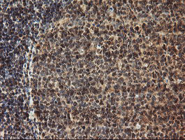 m10582 anti tle2 mouse monoclonal antibody clone id oti5a6 ihc testing 4