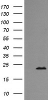 HEK293T cells were transfected with the pCMV6-ENTRY control (Left lane) or pCMV6-ENTRY RAB24 (Right lane) cDNA for 48 hrs and lysed