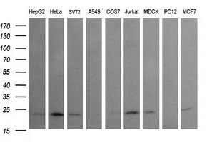 Western blot analysis of extracts (35ug) from 9 different cell lines by using anti-RAB24 monoclonal antibody (HepG2: human; HeLa: human; SVT2: mouse; A549: human; COS7: monkey; Jurkat: human; MDCK: canine; PC12: rat; MCF7: human)