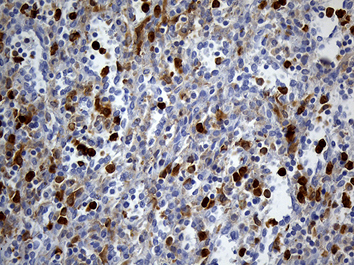 Immunohistochemical staining of paraffin-embedded Human spleen tissue within the normal limits using anti-UBE3B mouse monoclonal antibody