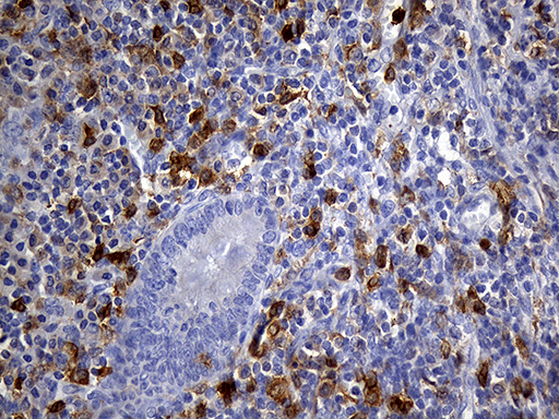 Immunohistochemical staining of paraffin-embedded Human appendix tissue within the normal limits using anti-UBE3B mouse monoclonal antibody