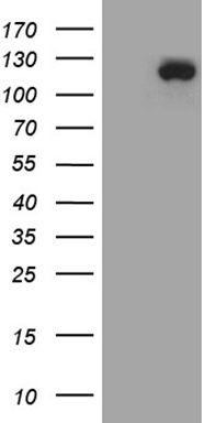 HEK293T cells were transfected with the pCMV6-ENTRY control (Left lane) or pCMV6-ENTRY UBE3B (Right lane) cDNA for 48 hrs and lysed