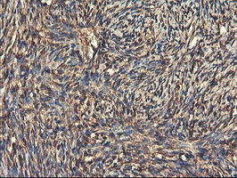 Immunohistochemical staining of paraffin-embedded Human Ovary tissue within the normal limits using anti-RNPEP mouse monoclonal antibody. (Heat-induced epitope retrieval by 10mM citric buffer Immunohistochemical staining of paraffin-embedded Human Ovary tissue within the normal limits using anti-RNPEP mouse monoclonal antibody. (Heat-induced epitope retrieval by 10mM citric buffer
