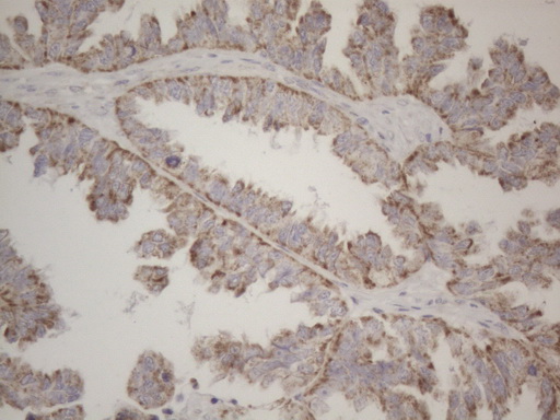 m10693 anti mrpl10 mouse monoclonal antibody clone id oti2b4 ihc testing 2