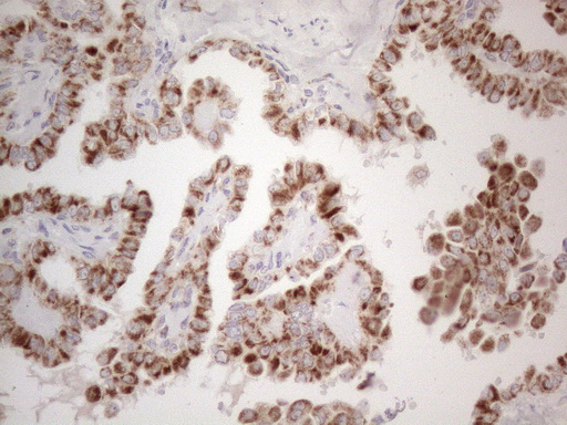 m10693 anti mrpl10 mouse monoclonal antibody clone id oti2b4 ihc testing 3
