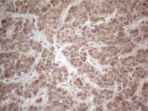 m10693 anti mrpl10 mouse monoclonal antibody clone id oti2b4 ihc testing 9