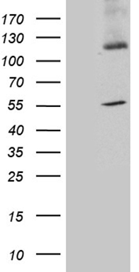 HEK293T cells were transfected with the pCMV6-ENTRY control (Left lane) or pCMV6-ENTRY SYT11 (Right lane) cDNA for 48 hrs and lysed