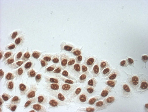 Immunocytochemistry staining of MCF-7 cells using anti-SNRPB2 mouse monoclonal antibody (M10709-1) (1:100)