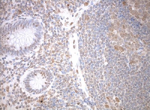 Immunohistochemical staining of paraffinembedded appendix using anti-SNRPB2 C/N M10709-1 clone OTI3A7 mouse monoclonal
antibody